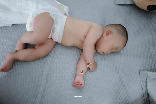 沅江宝宝褶皱处擦粉还是油